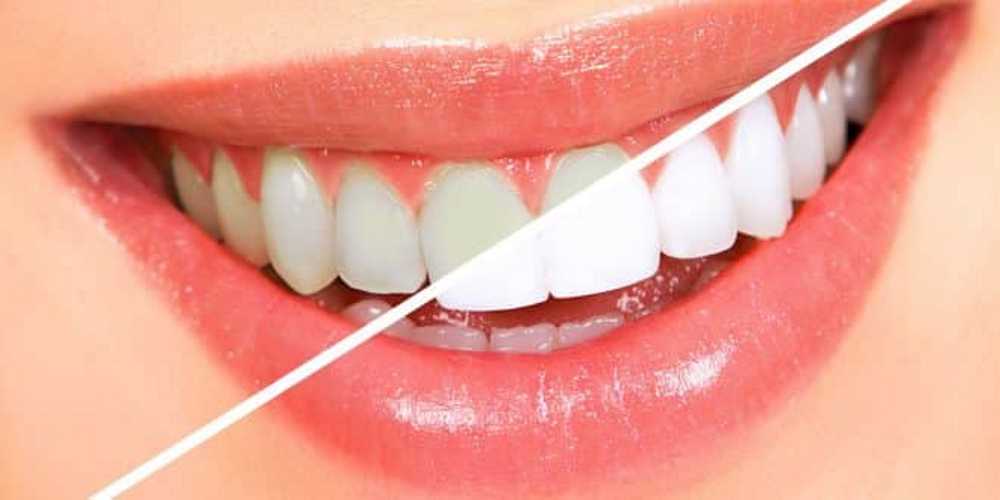 خمیر دندان سفید کننده ملایم مراقبت روزانه 