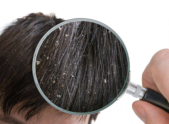 شامپو ضد شوره مدیلن مناسب موهای معمولی 200 میلی لیتر
