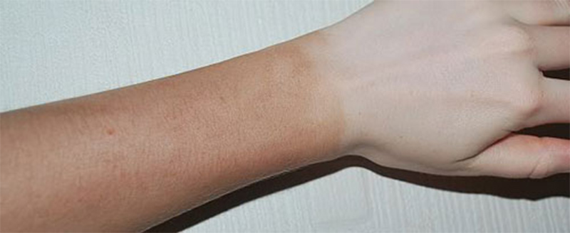 فوم برنز کننده پوست پریم مدل Corpex حجم 150 میلی لیتر
